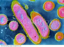 Erysipelothrix rhusiopathiae